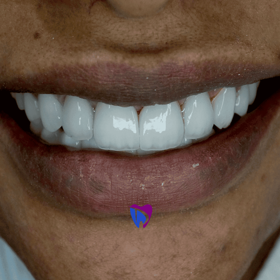 Dr. Talha best dentist Hollywood smile offer image 1