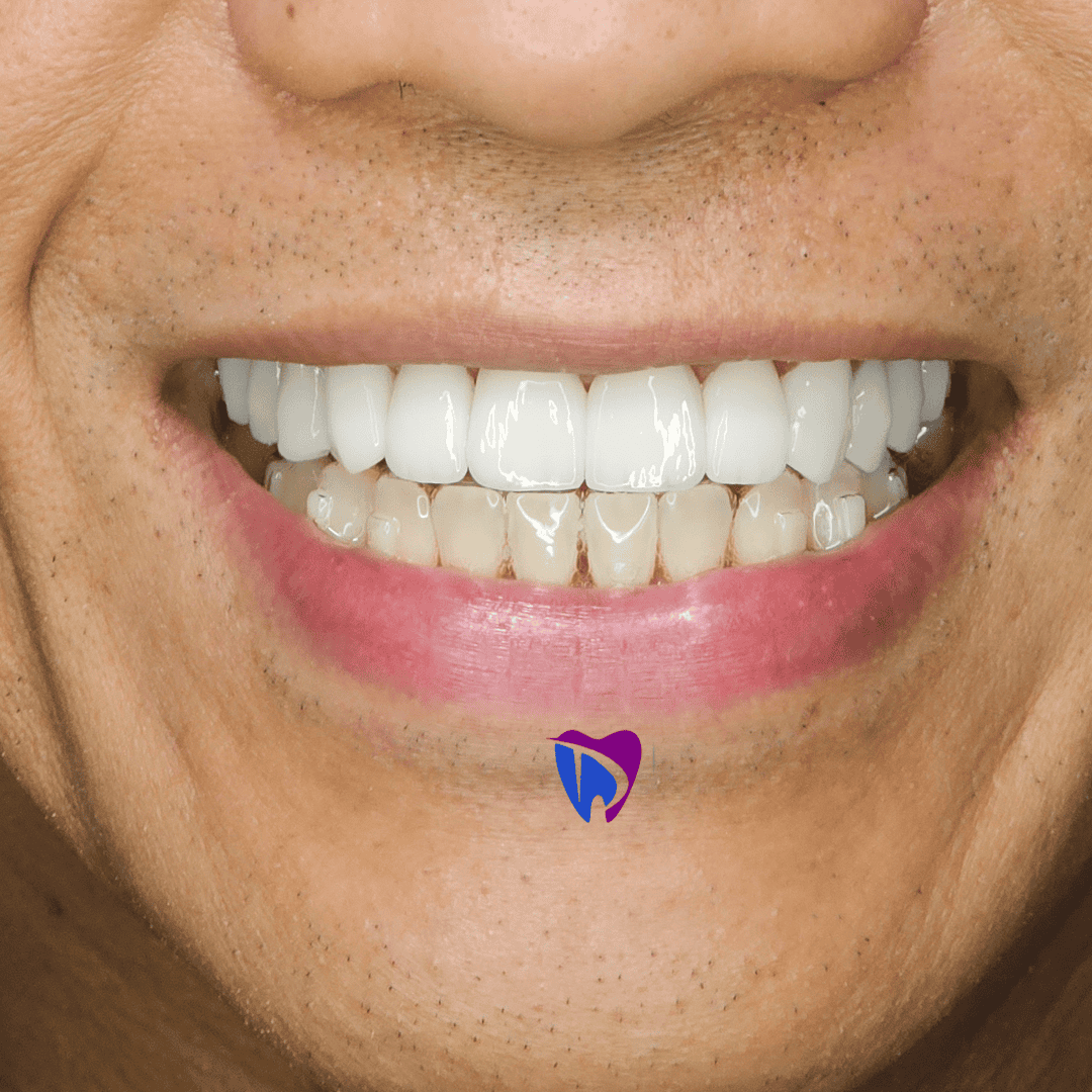 Dr. Talha best dentist Hollywood smile offer image 4